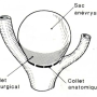 Figure 1 : Collet anatomique vs collet chirurgical. Schéma tiré de Castel et (…)
