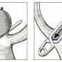 Figure 4 : Allongement du collet anévrismal lors du clippage. Schéma tiré de (…)